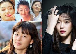 女明星出国整容,女明星海外整形之旅揭秘