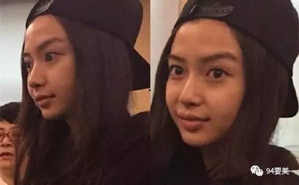 假体明星,美丽背后的秘密与争议